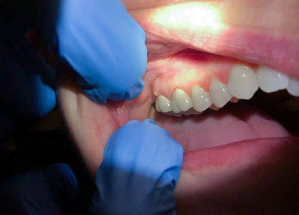 Best Emergency Cosmetic Dentistry (e.g., broken veneers) in Goliad, TX